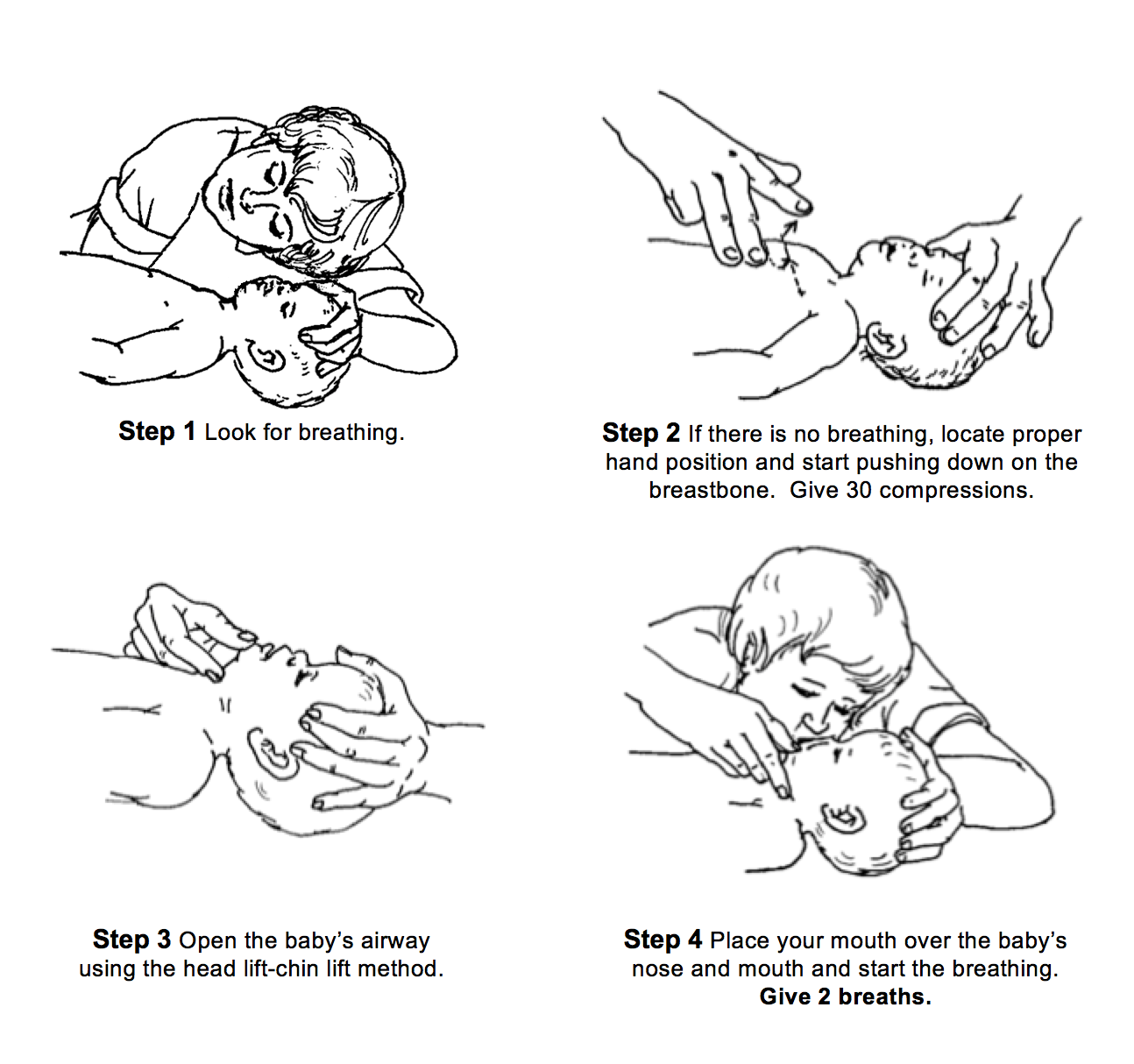 How and When to Perform CPR