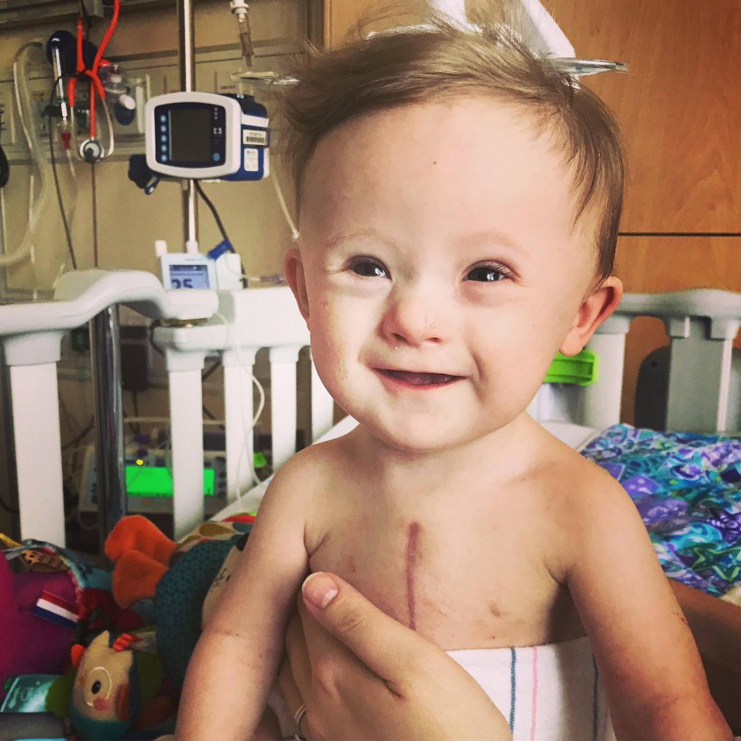 Benjamin, a baby with a congenital heart defect called Tetralogy of Fallot 